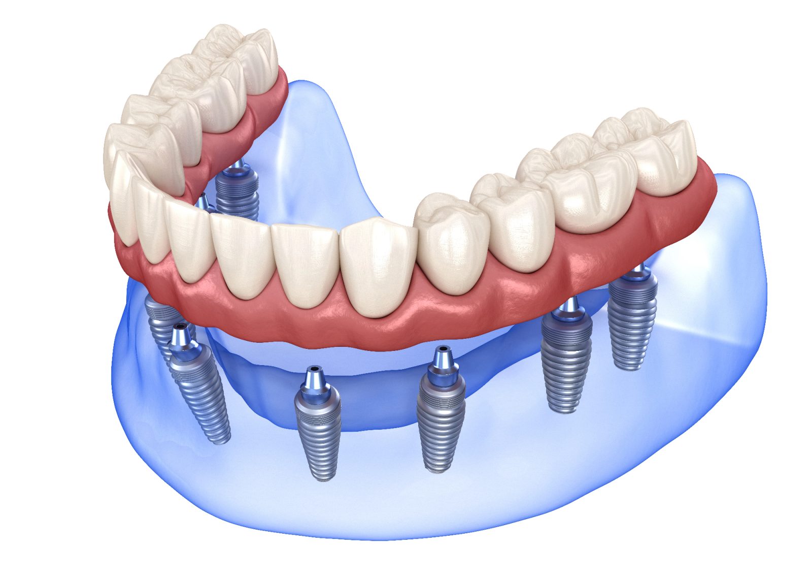 All on 6 je očetu povrnil nasmeh